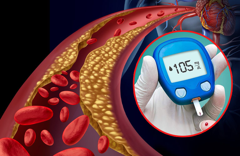 Mỡ máu và tiểu đường