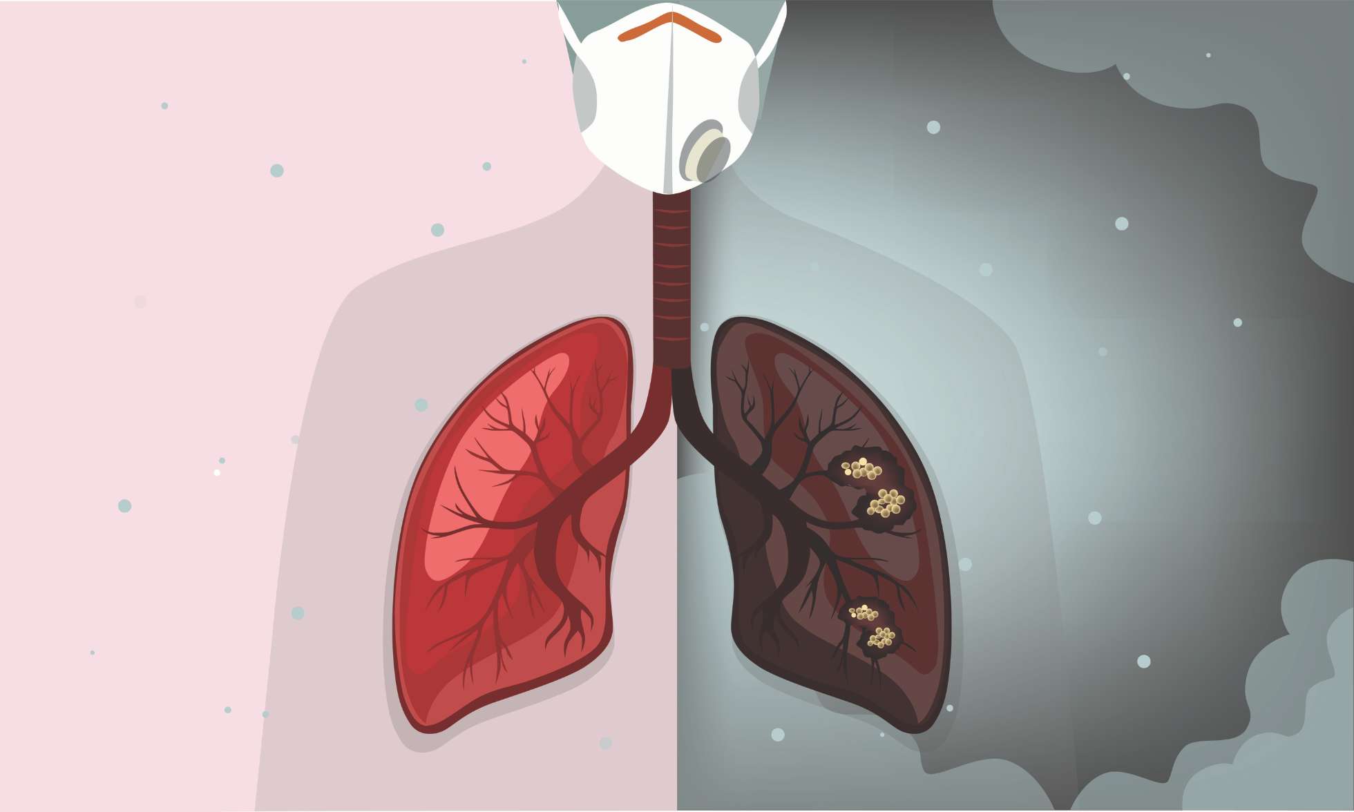 phổi nhiễm bụi mịn