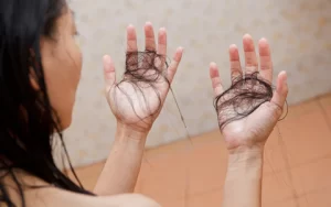 rụng tóc