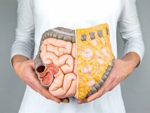 chỉ số mỡ nội tạng