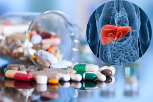 tổn thương gan do thuốc giảm đau